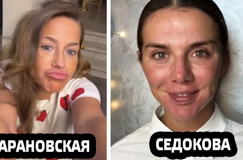  «Смело»: снимки знаменитостей, которые похвастали красотой без макияжа и фильтров