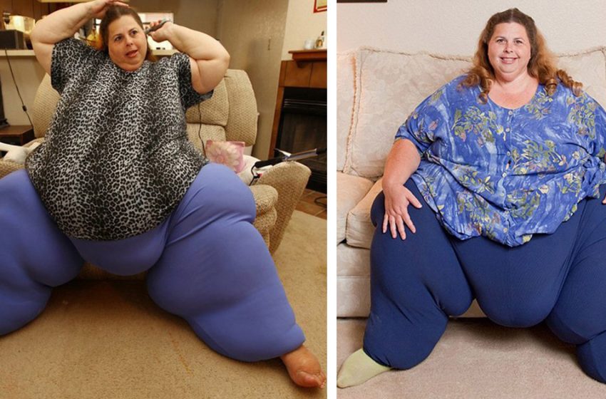  «Путь длинною в 10 лет»: как выглядит сейчас женщина, похудевшая на 235 кг в 57 лет