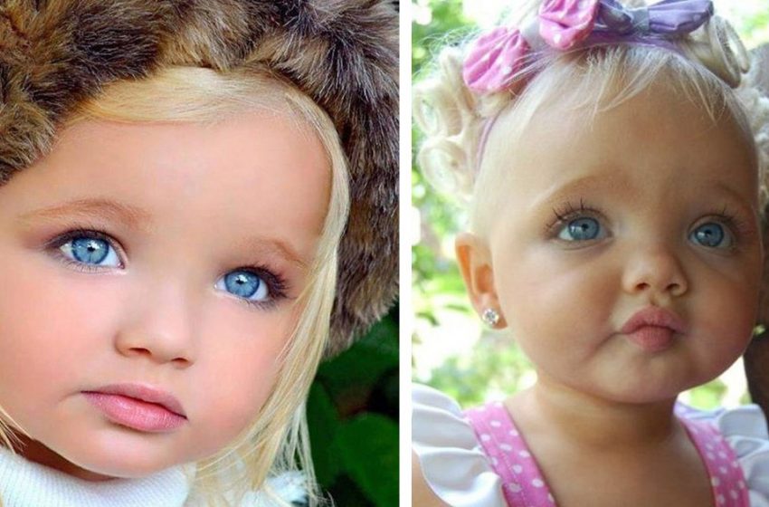  Излезнала от чудесния свят: Как изглежда сега момичето, наречено кукла поради необичайния си външен вид?