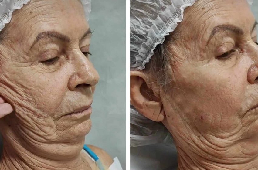  “Тя е непознаваема след пластична хирургия”: Стара дама се превърна в млада красавица!