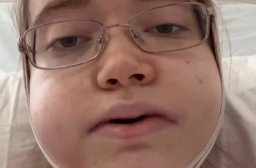  Тя беше 24 часа подложена на операция на челюстта и се върна напълно непозната: Снимките ѝ!
