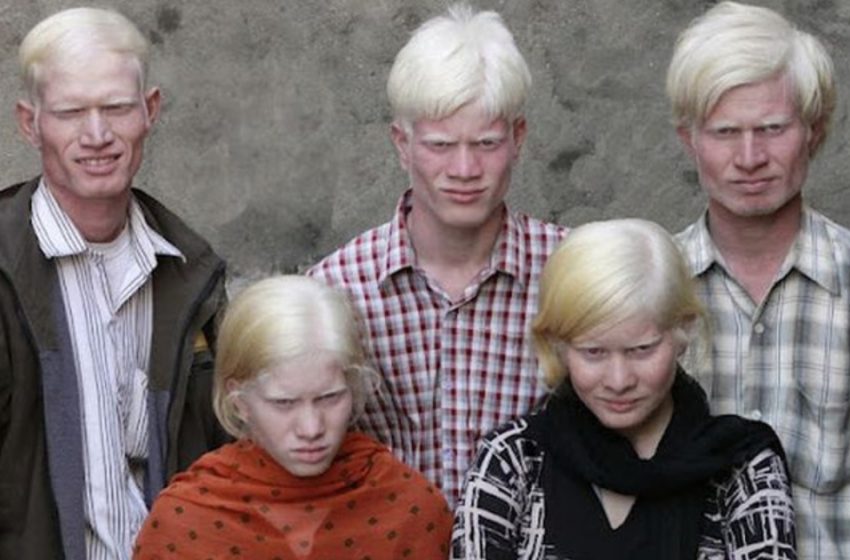  Най-голямото албинос семейство в света привлича вниманието! Вижте още снимки!