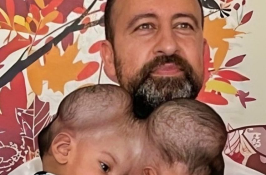  Невероятното пътуване на сиамските близнаци, споделящи мозъчна тъкан след рискована операция!: Вижте как изглеждат сега!