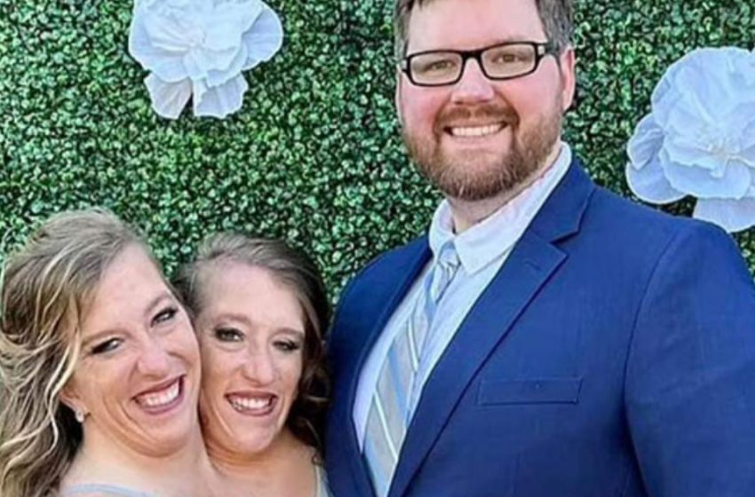  Близнаците Хенсел посрещат дете сред скептицизъм: Възможна ли е въобще бременност?